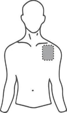 Tronco masculino con un área rectangular gris indicada en el hombro izquierdo, mostrando el lugar de aplicación del medicamento