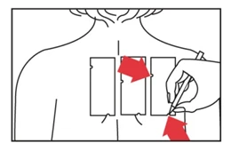 Linea schematica della schiena con tre campi rettangolari, una mano che tiene una penna e segna un campo, e frecce rosse che indicano la direzione dell'azione