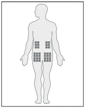 Silhouette del corpo umano in profilo con quattro aree indicate sull'addome, ognuna composta da nove piccoli quadrati