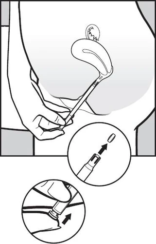 Ilustración que muestra el proceso de administración de un medicamento inyectable en el abdomen, así como primeros planos de la inserción de una cápsula en un dispositivo y de presionar el émbolo