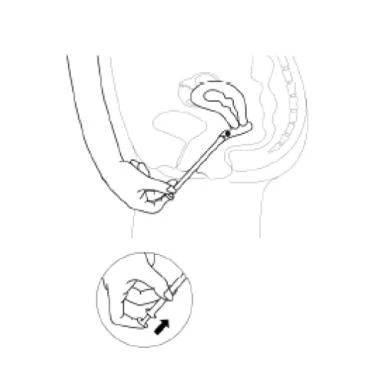 Schematic illustration showing a hand holding an applicator inserted into the vagina and a close-up indicating the grip of the device with an arrow