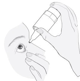 Mano che impugna un piccolo flacone con contagocce, applicando gocce nell'occhio, mentre l'altra mano solleva delicatamente la palpebra inferiore
