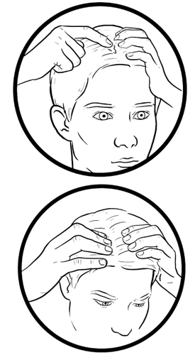 Dos ilustraciones dibujadas en blanco y negro que muestran manos masajeando la piel del cuero cabelludo de una persona con arrugas y líneas visibles en la frente