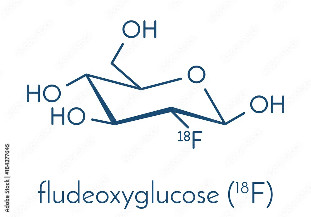 Fludeoxiglucosa (18F) UJV solución para inyección