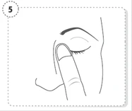 Un dito tira la palpebra inferiore per instillare le gocce nell'occhio, immagine con il numero 5 in un cerchio