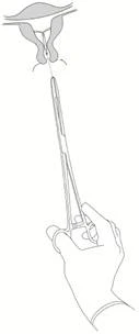 Hand holding a syringe injecting the needle into the muscle tissue of the thigh at an angle, with a schematic illustration of surrounding anatomical structures