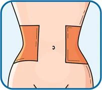 Dos rectángulos naranjas en los costados del tronco que indican los lugares de aplicación del medicamento, con el ombligo en el centro