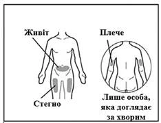 Esquema del cuerpo humano con zonas marcadas para inyección