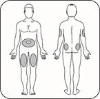 Human body diagram with marked injection sites