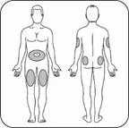 Schema del corpo umano con aree indicate per l'in