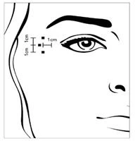 Rappresentazione schematica del volto con indicazione di un'area di 1 cm attorno all'occhio per definire la zona di somministrazione del farmaco