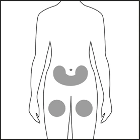 Rappresentazione schematica del corpo umano con aree indicate per l'iniezione