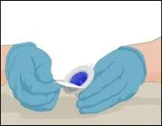 Hands in blue medical gloves holding an ampoule with blue liquid, prepared for drug administration