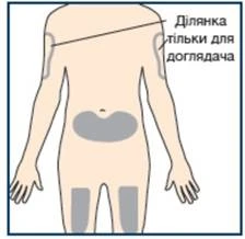 Esquema del cuerpo humano con áreas resaltadas para inyección